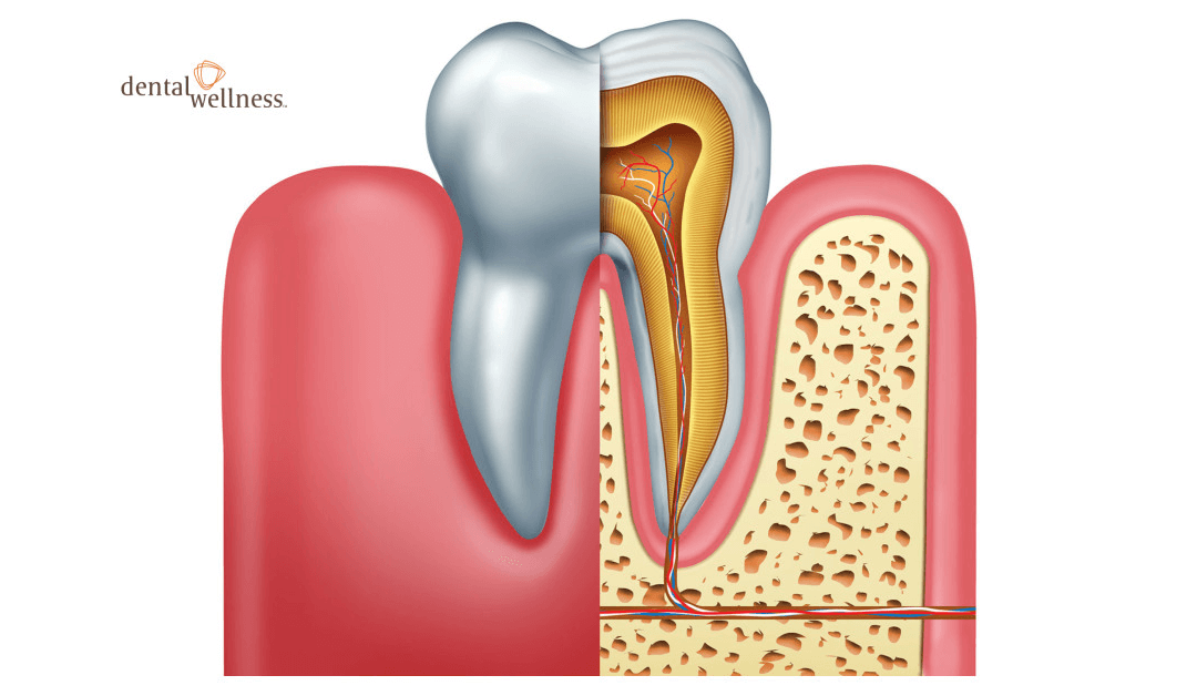 Is There Any Alternative to Root Canal Treatments? Part 1