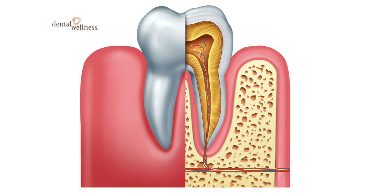 Is there any alternative to root canal treatments
