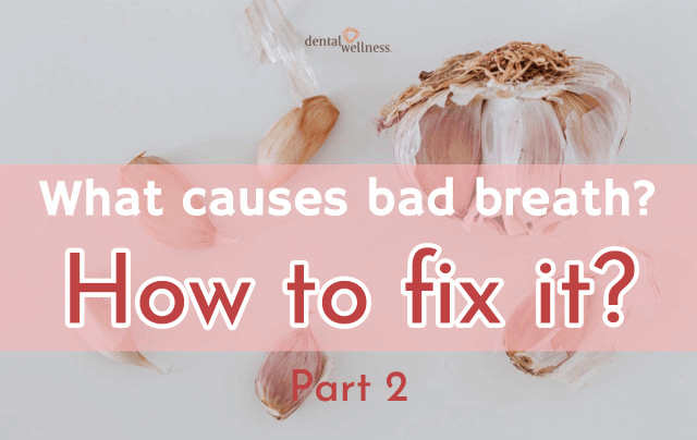 What causes bad breath? – How to fix it! Part 2