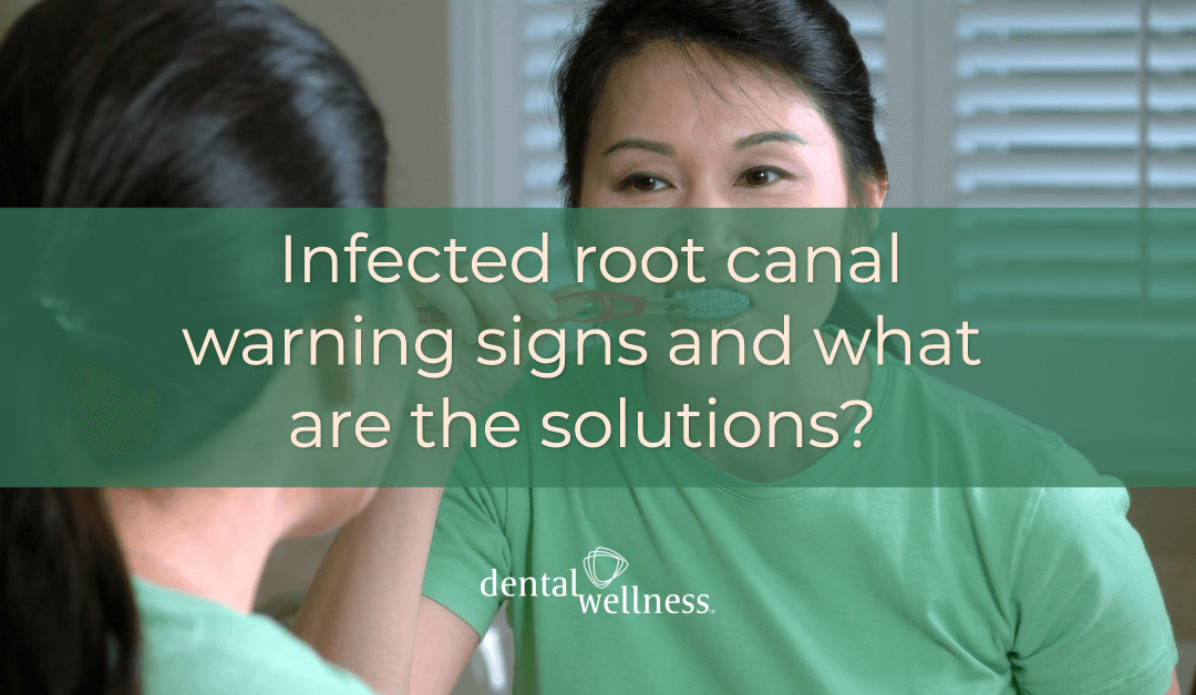 Infected root canal warning signs and what are the solutions?