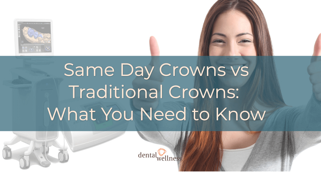 What are same-day crowns, and is it even possible?