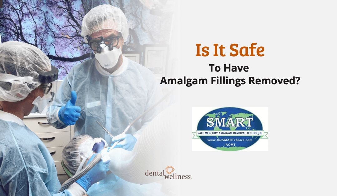 Is It Safe to Have Amalgam Fillings Removed?
