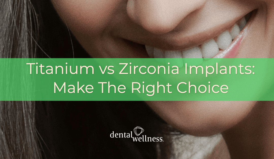 Titanium vs Zirconia Implants: Make The Right Choice
