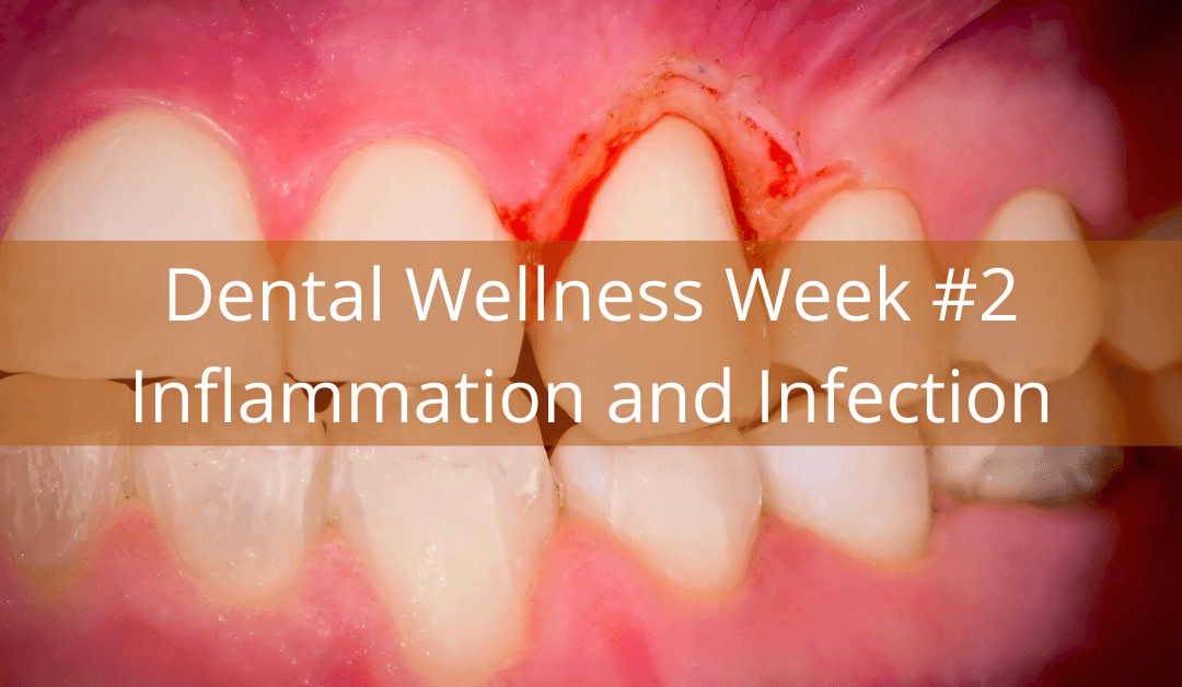 Dental Wellness Week #2 – Inflammation and Infection