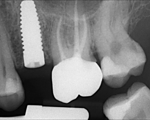 Light box(1)_Intraoral