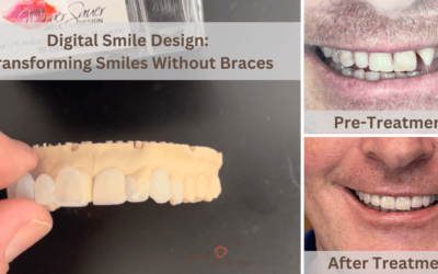 Digital Smile Design: Transforming Smiles Without Braces