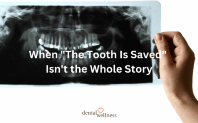When “The Tooth Is Saved” Isn’t the Whole Story