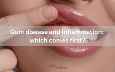 Gum disease and inflammation: which comes first?